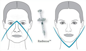 Устранение признаков старения препаратом Радиес