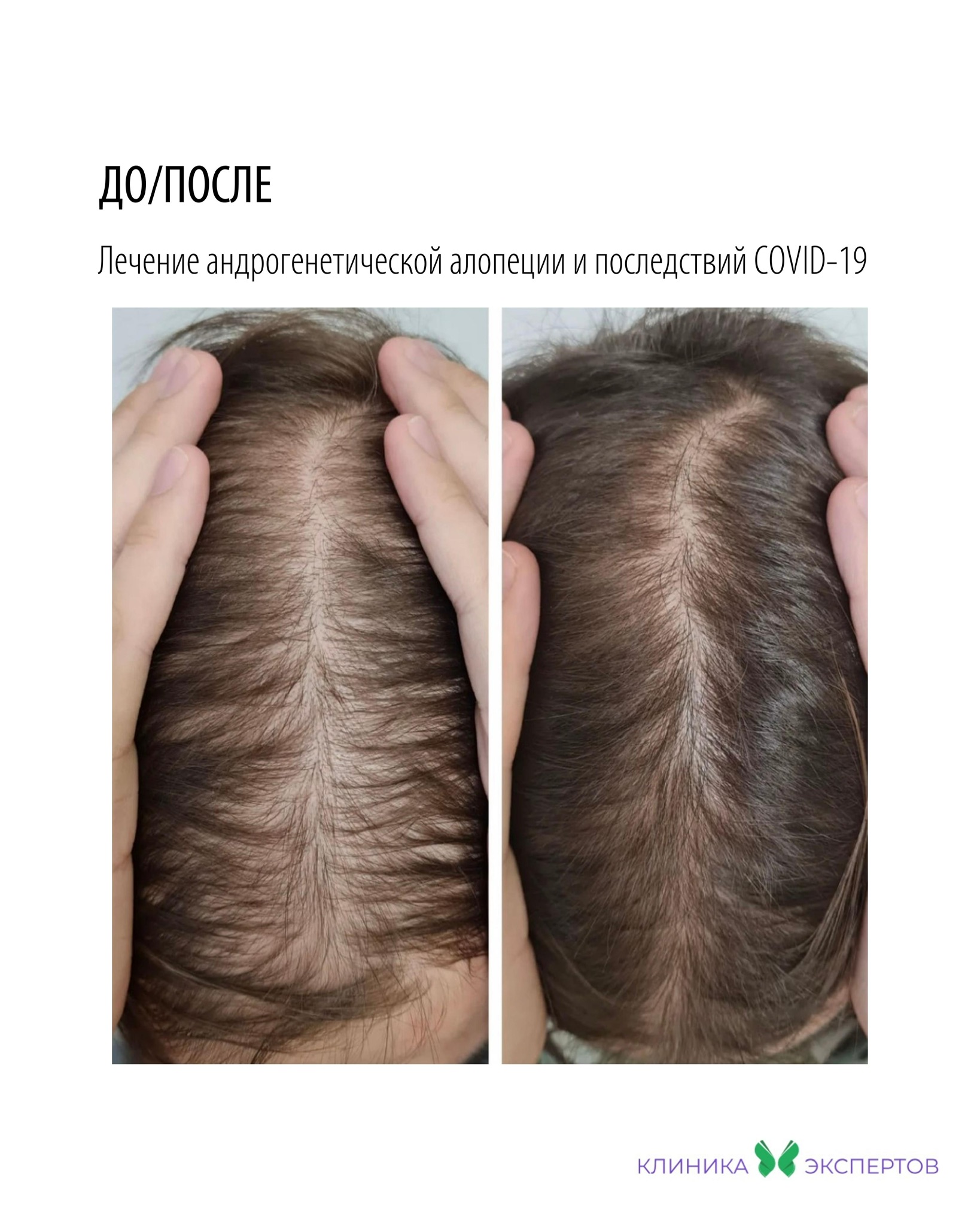 Биозавивка волос мелкими локонами с выездом на дом в Москве