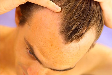 Какие народные средства могут остановить выпадение волос?